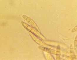 병원균(자낭포자)