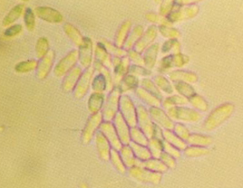 병원균( 병포자)