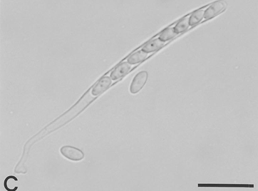 병원균(자낭과 자낭포자)