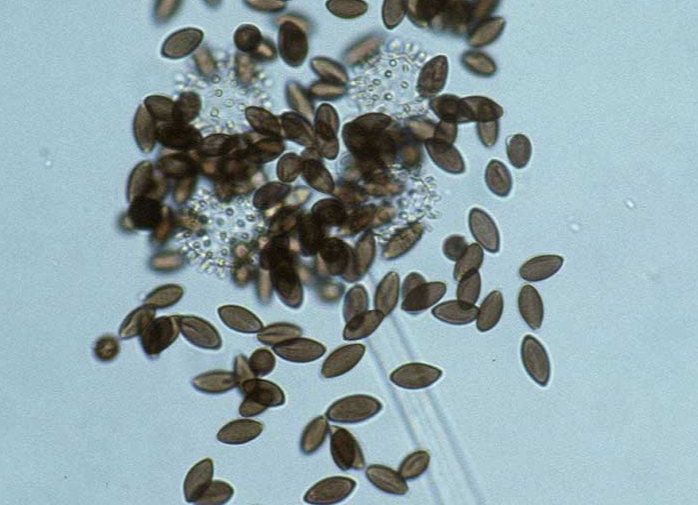 병원균(분생자경)