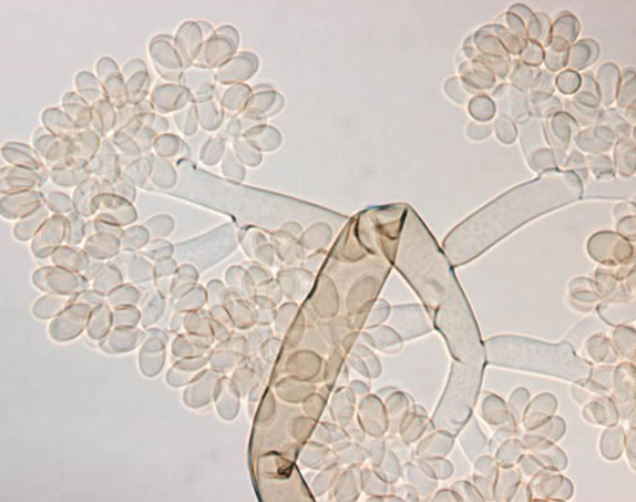 병원균(B. cinerea 분생자경과 분생포자) 