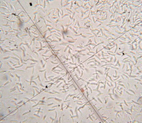  병원균(병포자)