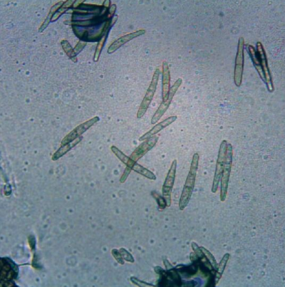 땅콩 검은무늬병 병원균 분생포자