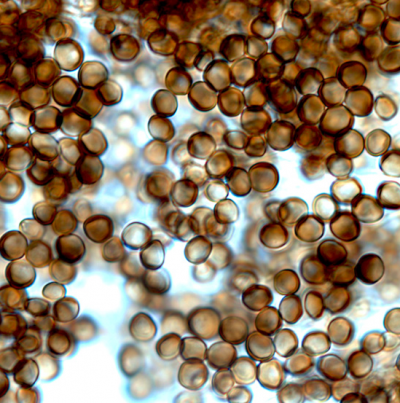 귀리 깜부기병 병원균 (U. hordei)