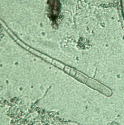 참깨 잎마름병 병원균 A. longgissima 분생포자