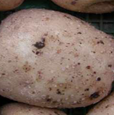 피목 비대 증상