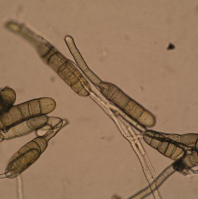 귀리 줄무늬병 병원균 분생포자