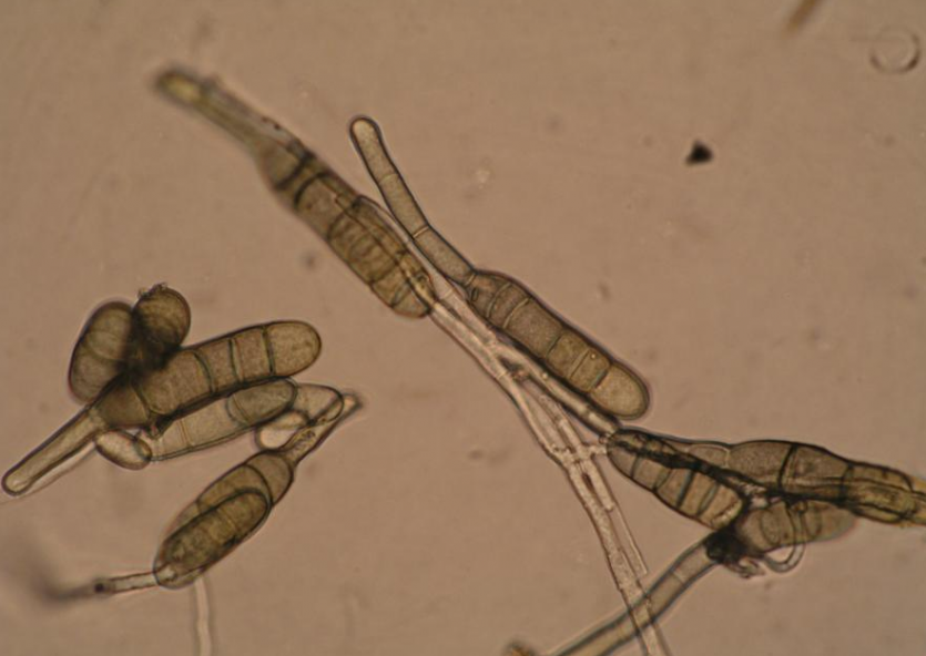 귀리 줄무늬병 병원균 분생포자