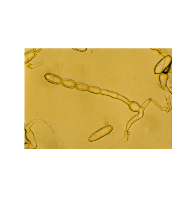 귀리 흰가루병 병원균 분생자경