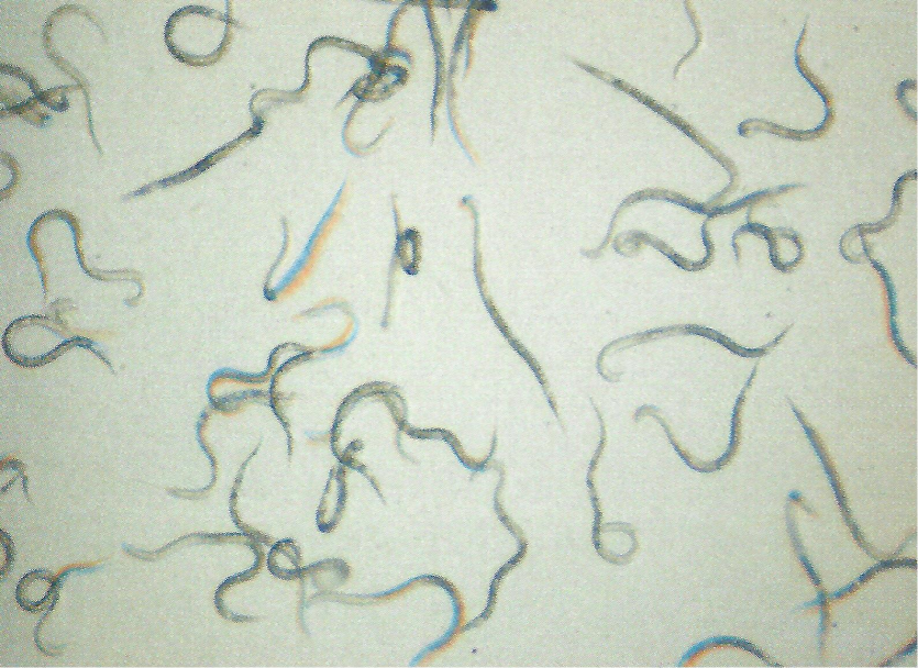 뿌리혹선충 유충