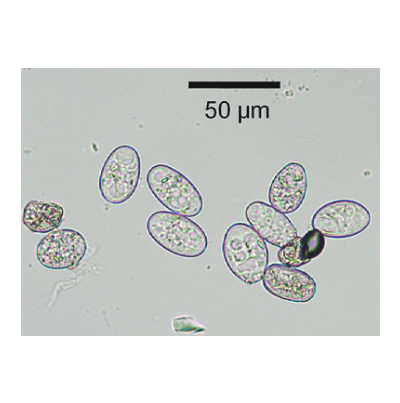 녹두 흰가루병 병원균 분생포자