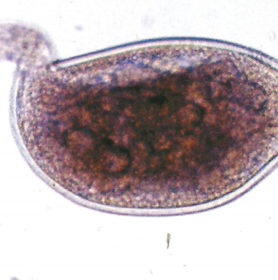 뿌리혹선충 암컷 성충