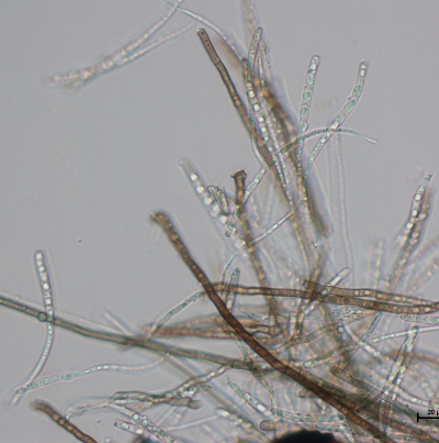 녹두 자주무늬병 병원균 분생포자