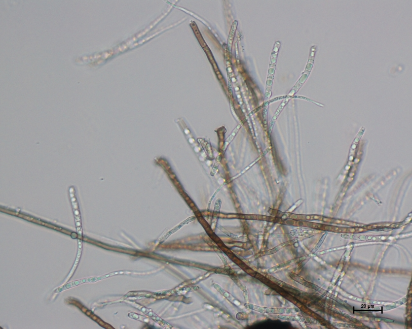 녹두 자주무늬병 병원균 분생포자