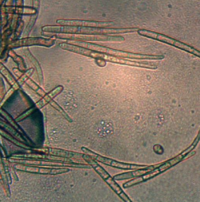 땅콩 갈색무늬병 병원균 분생포자