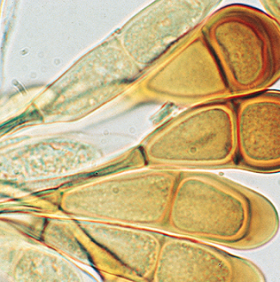 귀리 줄기녹병 병원균 동포자
