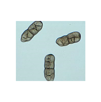 병원균(S. solani)