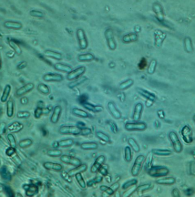 병원균(병포자)