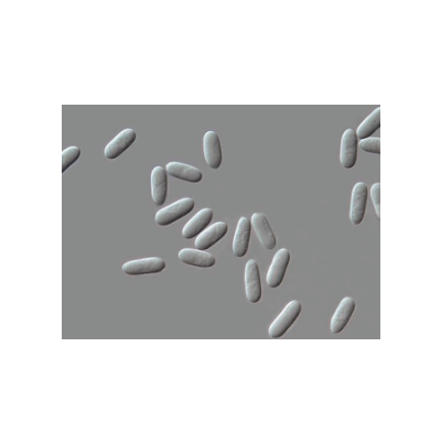 병원균 분생포자(C. gloeosporioides)