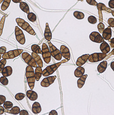 병원균(분생포자)
