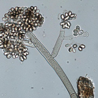 병원균(분생포자)