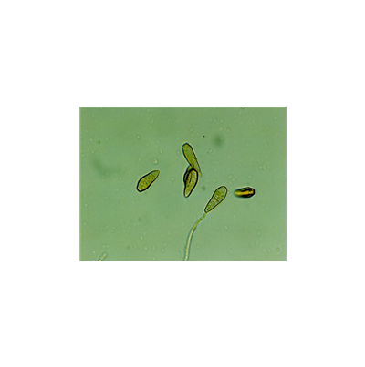 병원균(분생포자)