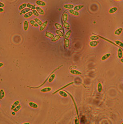  병원균(α 및 β 병포자) 