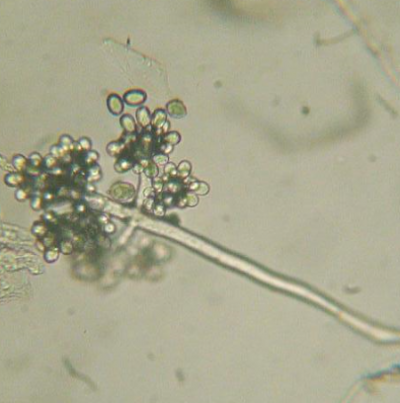 병원균(분생자경 및 분생포자)