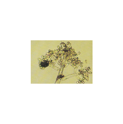  병원균(분생자경 및 분생포자)