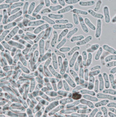 병원균(병포자)