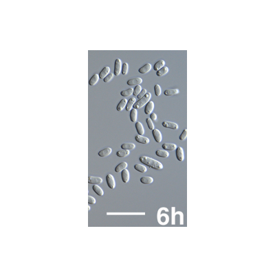 병원균(분생포자)