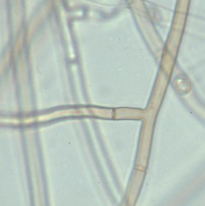병원균(Rhizoctonia 균사)
