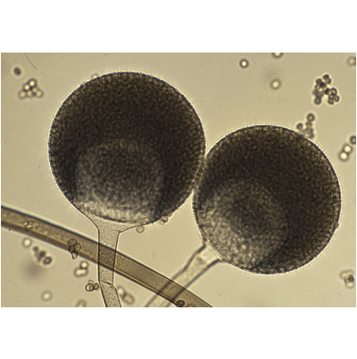 병원균(포자낭)