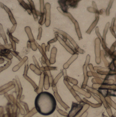 병원균(분생포자)
