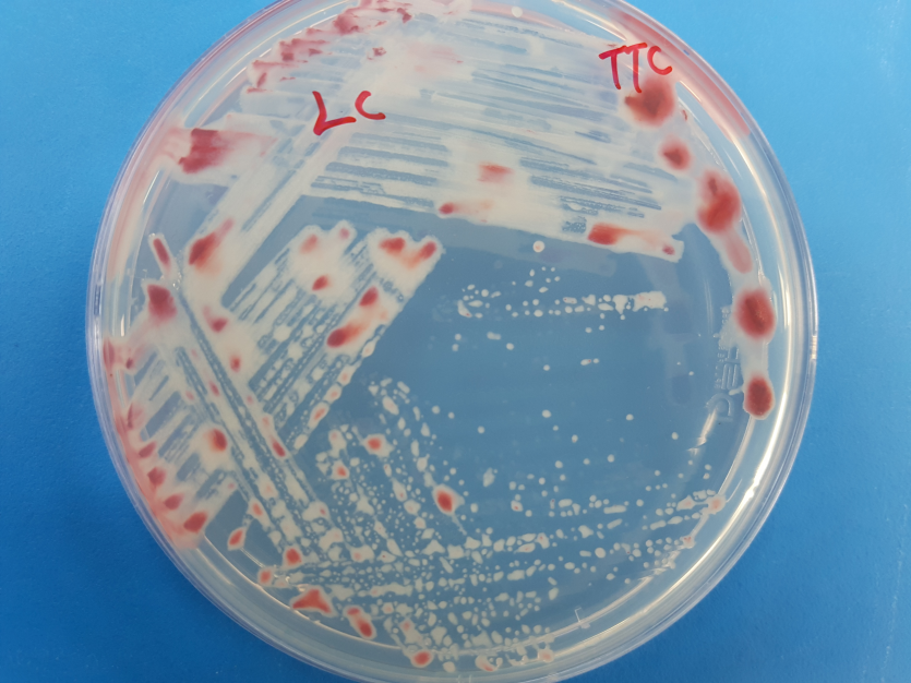 배지(TTC)에 형성된 병원세균