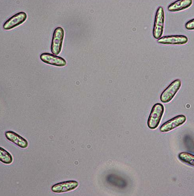 병원균(C. acutatum)분생포자