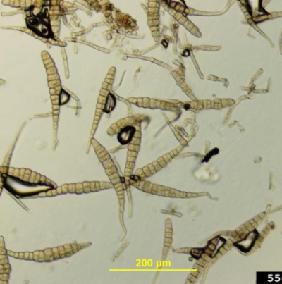 병원균(A.brassicae)