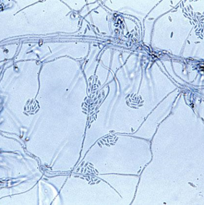병원균(Acremonnium)
