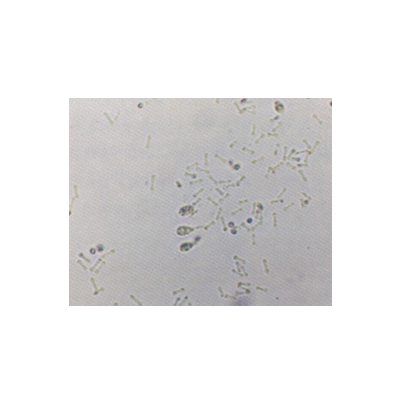 병원균(병포자)