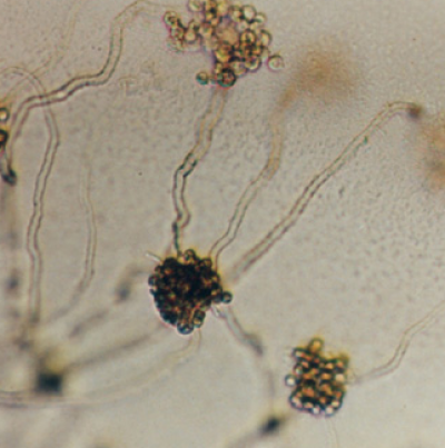 병원균(유주자)