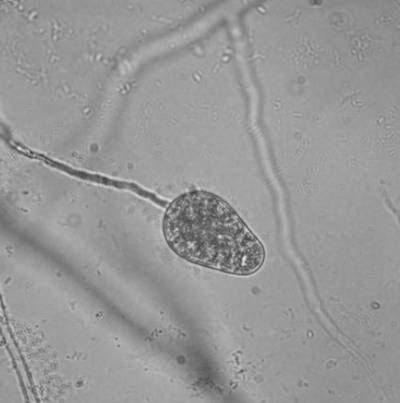 병원균(유주자낭)