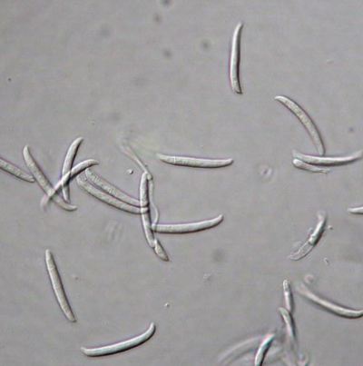병원균(F. solani 분생포자) 