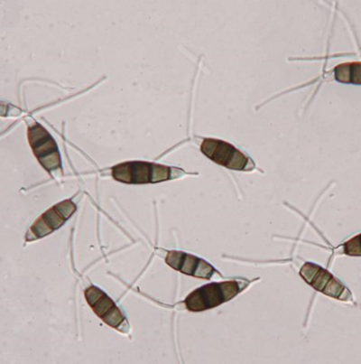 병원균(분생포자)