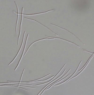 병원균(병포자)
