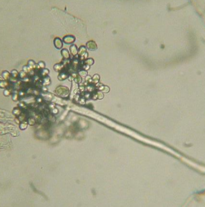 병원균(분생자경과 분생포자) 