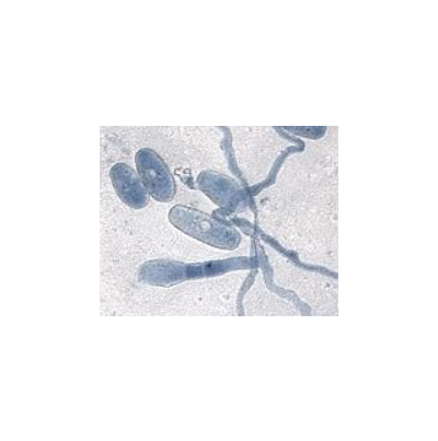 병원균(분생포자)