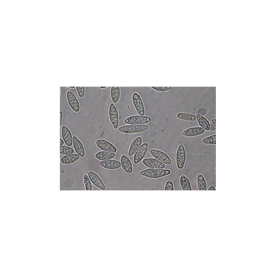 병원균(병포자)