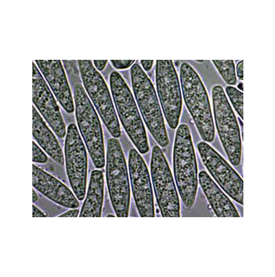 병원균(B. dothidea) 병포자