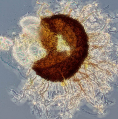 병원균(자낭각과 자낭) 