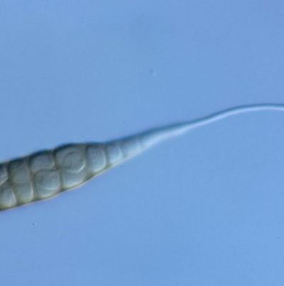 병원균(분생포자)